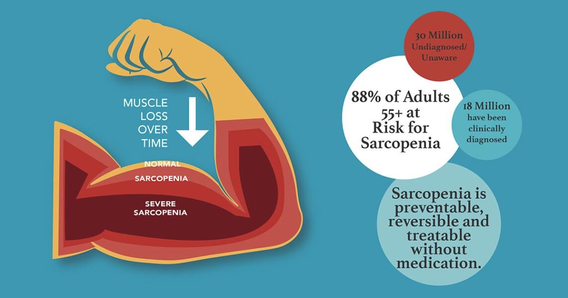 Human Growth Hormone And Testosterone In Treating Sarcopenia