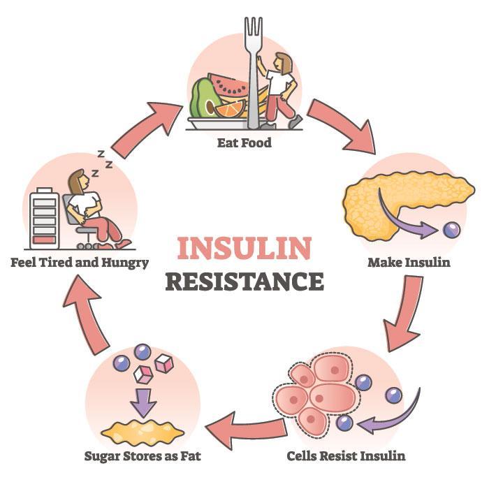 Insulin resistance and hormone imbalance