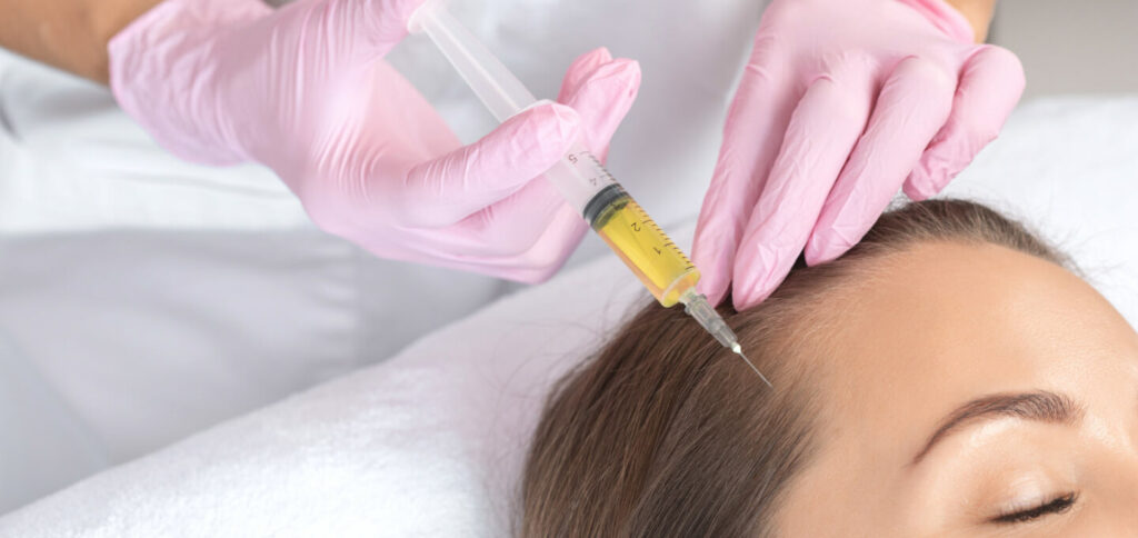 Clinician administering PRP into the scalp