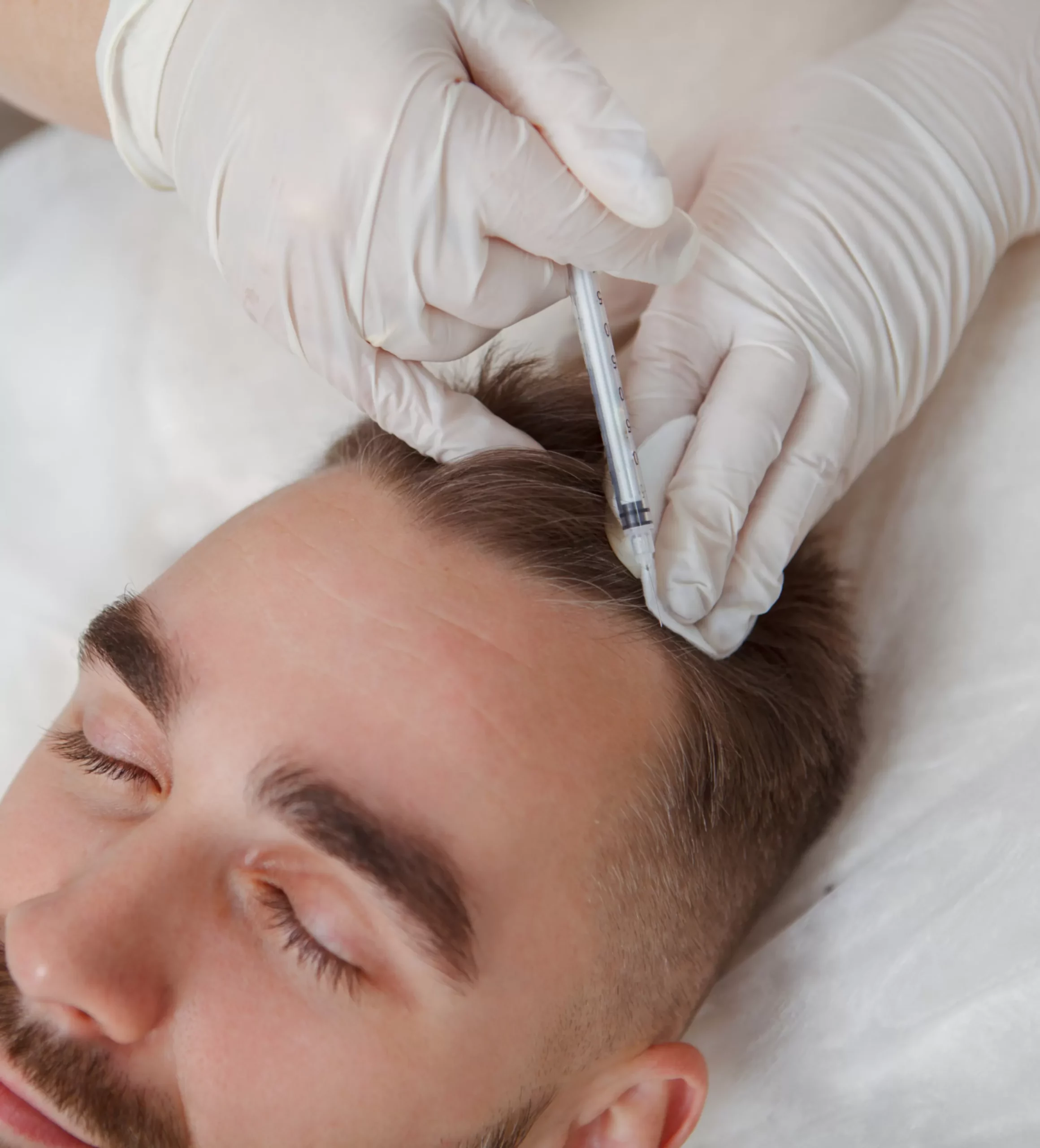 Growth-Factor-Injections-for-hair-loss