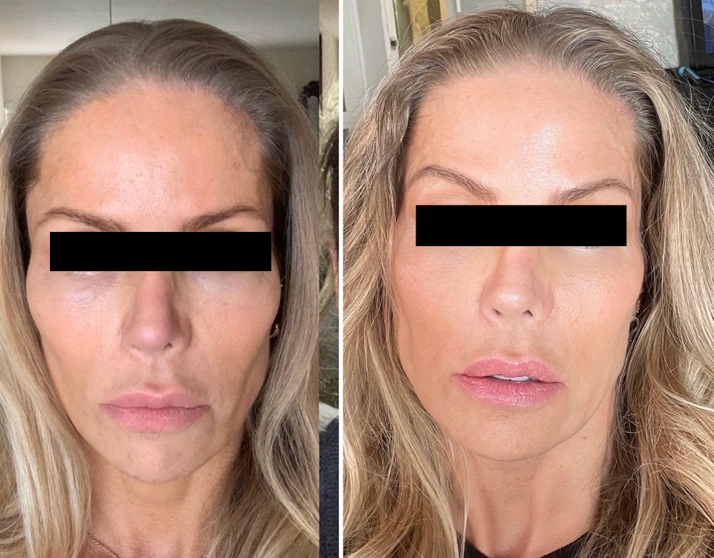 before-and-after-JC2