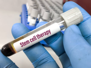 Stem Cell Therapy