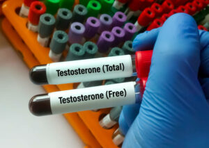 Hormone Replacement Therapy