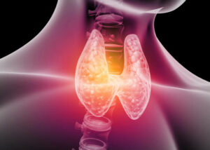 Hypothyroidism Treatment